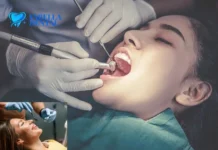 Teeth Filling Services for Restoring and Protecting Your Smile