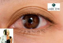 Effective Pterygium Treatment in Houston for Clear and Healthy Vision