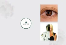 How to Cure Pterygium with Effective Treatment and Expert Care Options
