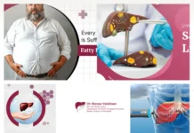 Top Liver Cirrhosis Specialist in Ahmedabad for Expert Diagnosis and Treatment