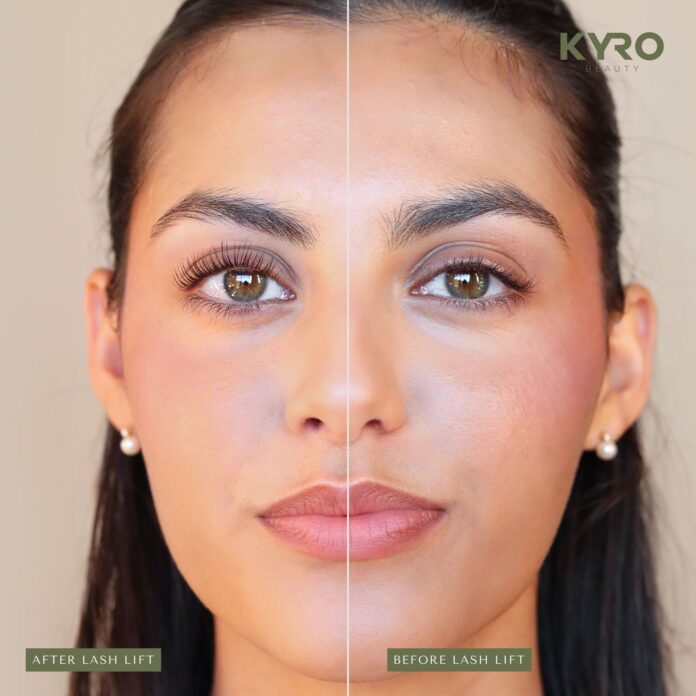 imgi_54_kyro_-_before_-_after_-_website_8c27b149-da51-4d10-8687-b0a966a9495d-1788508126157-44a7fc49